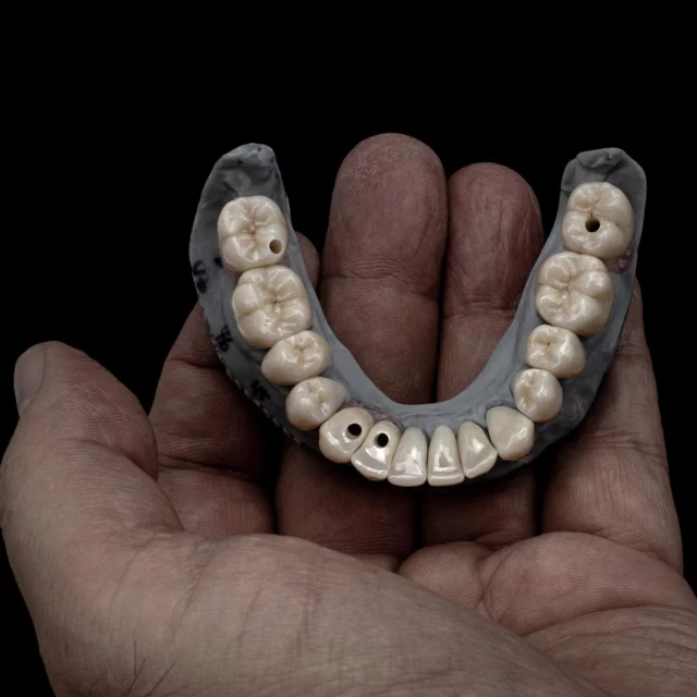 ➜ „All-In“
Micro-Layering ist eine bedeutende Innovation in unserer Zirkonoxid Verarbeitung geworden! Diese Technik hat nicht nur die Produktivität nachhaltig verbessert, sondern auch die ästhetische Ansprüche erfüllt. Solche Fortschritte können einen großen Unterschied in der Qualität und Effizienz der Arbeit machen. 

Heute ➜ Donnerstag // Zirkon*oxid-Talk 3.Staffel

- Micro-Layering
- HD-Milling
- Präzision & Effizienz

24.10.2024
28.11.2024

18:00 bis 19:00 Uhr, MEZ via Teams
Anmeldung bei ARGEN (☎️, Mail) 

Inventarliste:

3Shape Trios 5 Intraoralscanner
SIPEA Modellerstellung
DYAMACH DS1+ HD-milling
ARGEN Z HT+ML
Panther Polishing Instruments
GC Aadva Lab Scanner 3
GC Initial IQ ONE SQIN
SMILE LINE Instrumente 
.
.
.
.
.
#siriusceramics 
#GCInitialIQONESQIN 
#OneSqin 
#GCGermany 
#ARGEN_Z_Highlights 
#masterclassbycarstenfischer 
#Multilayerzirkonoxid 
#microlayering 
#microlayeringsolutions 
#micro-layering 
#Multilayer 
#masterclass 
#argenmatchmaker 
#gcinitialworld
#pantherpremiuminstruments