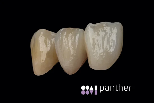 ✨ Panther Polishing Paste – for perfect high gloss! 🦷💎

➜ Even when it gets tough – make it shine! 🌟💯

#PantherPolishing #HighGlossFinish #ShineBright #DentalTools #siriusceramics #pantherpremiuminstruments  #pantherandfriends  #

🙏Jo!