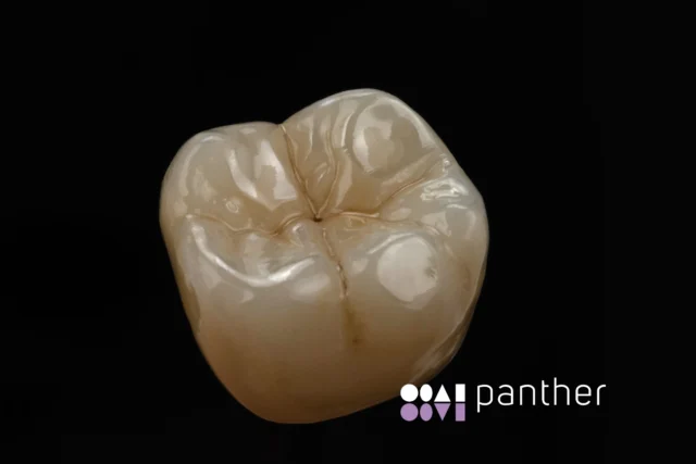 ✨ Panther Premium Polishing ✨

Zahntechnische Arbeit ZT Naomi Sulzmann, Team Sirius Ceramics 

➜  Zirconia processing on highest level! 🛠️🔝

#PantherPolishing #CeramicPro #HighEndFinish #ShineBright #siriusceramics #pantherpremiuminstruments 
#pantherandfriends