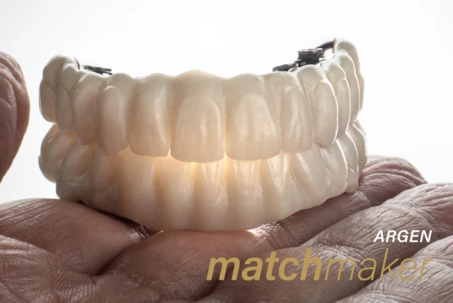 ➜ Material performance at its best!
.
.
.
#Zahntechnik  #siriusceramics #masterclassbycarstenfischer #ARGEN_Z_Highlights #argenmatchmaker