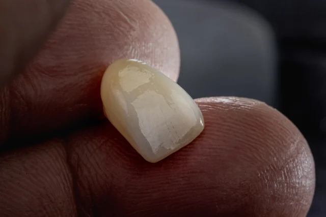 ✨ Etwas Nachschub.
MegaGen AnyRidge 🚀 in Kombination mit ARGEN Z Zirkonoxid, GC Initial IQ Lustre Pastes ONE + Initial ZR.
Und wieder einmal zeigt sich: Wenn alle Teampartner mit Respekt, Klarheit und echter Zusammenarbeit agieren, entsteht genau das kleine bisschen mehr, das den Unterschied macht. Hand in Hand. Punkt.
#MegaGen #AnyRidge #Implantologie #Zahntechnik #Teamwork Innovation GC ARGENZHTplusML ARGEN pantherpremiuminstruments GCInitial
.
.
.
Inventarliste:
Implantat/ Ti-Base : MegaGen
ARGEN Z Zirkonoxid
GC Initial IQ Lustre Pastes ONE + Initial ZR.
Panther Instruments
Smile Line Instruments 
DEKEMA Furnace Power